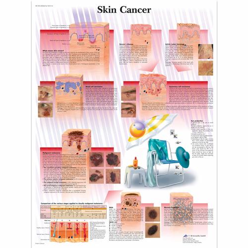 Skin Cancer, 1001514 [VR1295L], Плакаты по раку (заболевание)