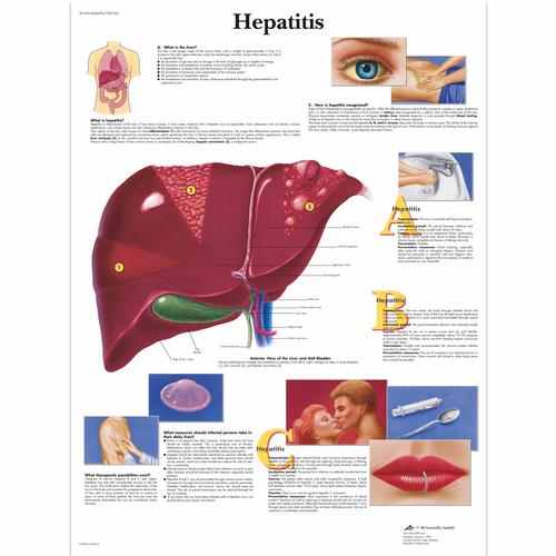 Hepatits, 1001552 [VR1435L], Плакаты по метаболической системе