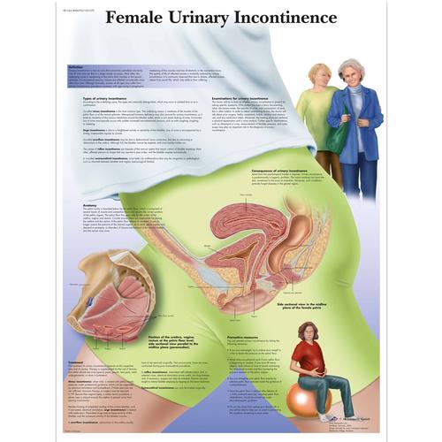 Pôster da Incontinência Urinária Feminina, 4006702 [VR1542UU], Ginecologia
