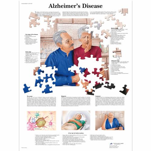 Pôster do Alzheimer, 4006713 [VR1628UU], Cérebro e sistema nervoso