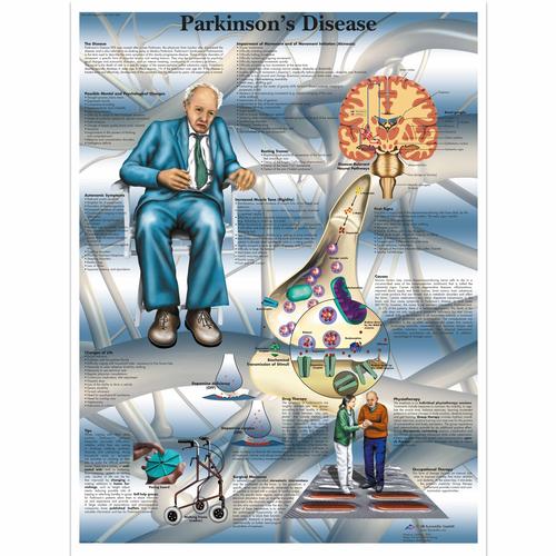 Parkinson's Disease, 4006714 [VR1629UU], Плакаты по мозгу и нервной системе