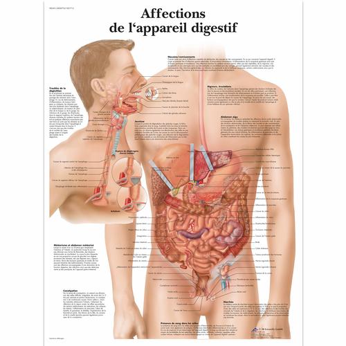Affections de L'appareil digestif, 4006774 [VR2431UU], 消化系统