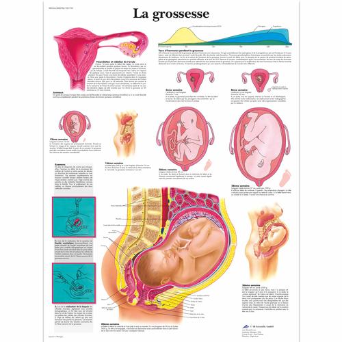 La grossesse, 4006786 [VR2554UU], Embarazo y Nacimiento

