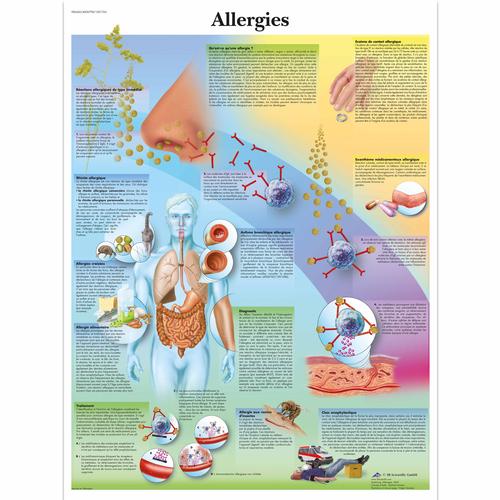 Lehrtafel - Allergies, 4006798 [VR2660UU], Immunsystem