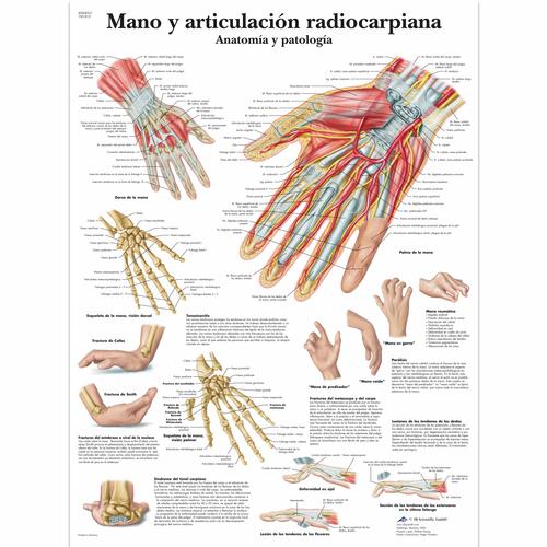 Mano y articulación radiocarpiana - Anatomía y patología, 1001815 [VR3171L], Csontrendszer