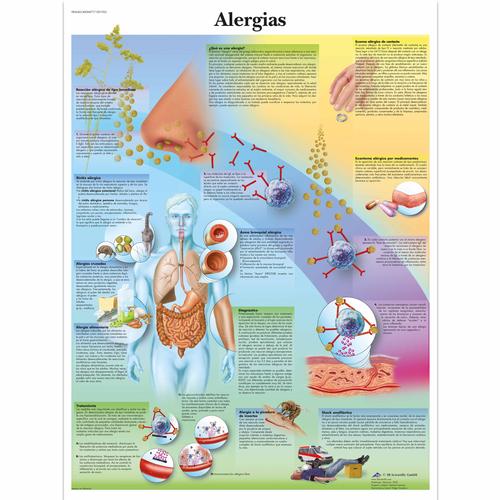 Alergias, 4006877 [VR3660UU], Immune System 
