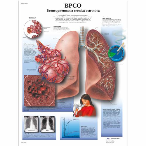 CODP Affezioni ostruttive polmonari croniche, 4006925 [VR4329UU], Educación sobre el tabaco