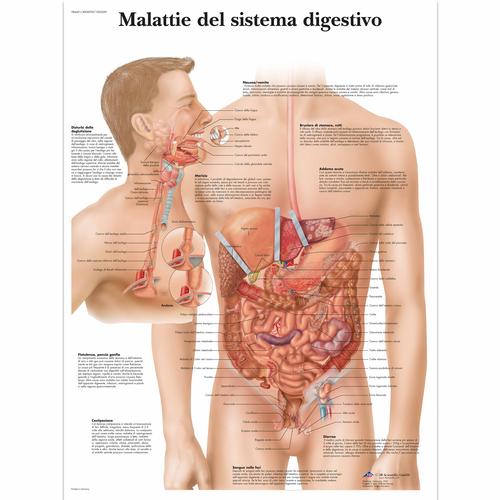 Malattie del sistema digestívo, 1002049 [VR4431L], Sistema digestivo