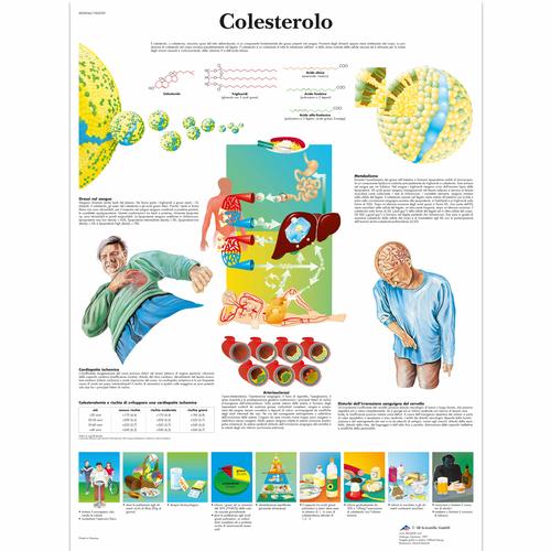 Il colesterolo, 1002059 [VR4452L], Плакаты по кардиоваскулярной системе