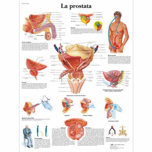 La prostata, 4006948 [VR4528UU], Sistema urinário