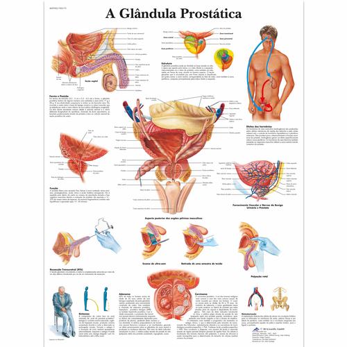 A glândula Prostatica, 50x67 cm, Laminado, 1002173 [VR5528L], Sistema Urinario