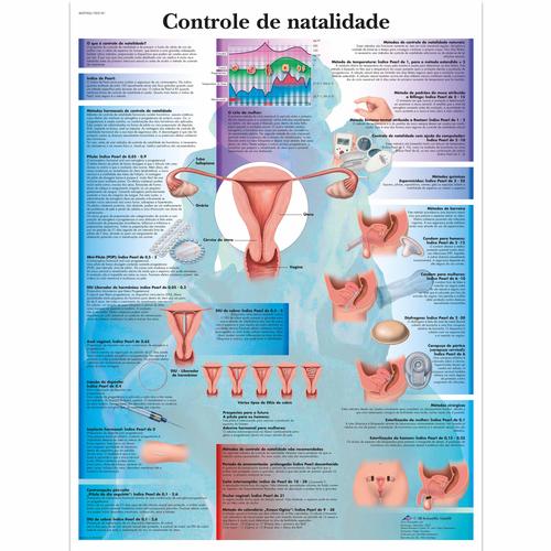 Controle de natalidade, 50x67 cm, Versão Papel, 4007006 [VR5591UU], Ginecologia
