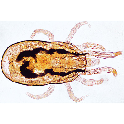 Arachnoidea and Myriapoda - German Slides, 1003863 [W13005], 无脊椎动物