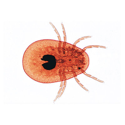 Arachnoidea and Myriapoda - Spanish, 1003866 [W13005S], 西班牙语