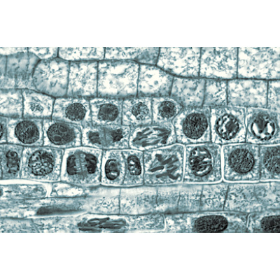 Angiospermas, Células e tecidos - Alemão, 1003908 [W13017], Preparados para microscopia LIEDER