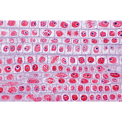 Angiospermas, Raiz - Francês, 1003913 [W13018F], Preparados para microscopia LIEDER