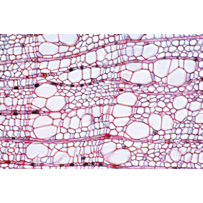 Angiospermas, Caule - Francês, 1003917 [W13019F], Preparados para microscopia LIEDER