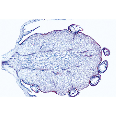 Angiospermas, Frutos e sementes - Alemão, 1003928 [W13022], Preparados para microscopia LIEDER
