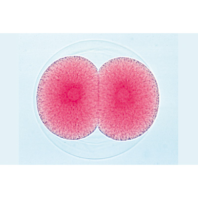 Embriologia de Ouriço-do-mar (Psammechinus miliaris) - Alemão, 1003944 [W13026], Preparados para microscopia LIEDER