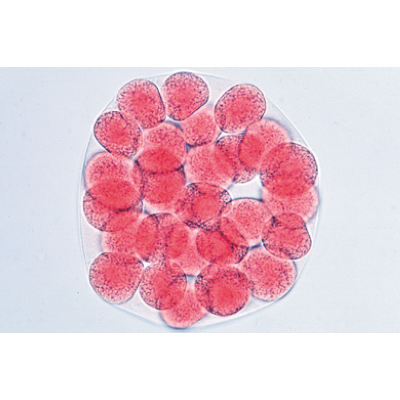 Embriologia de Ouriço-do-mar (Psammechinus miliaris) - Alemão, 1003944 [W13026], Preparados para microscopia LIEDER