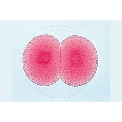 Embriologia de Ouriço-do-mar (Psammechinus miliaris) - Francês, 1003945 [W13026F], Preparados para microscopia LIEDER