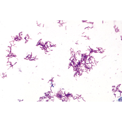 Мобилункус в мазке фото под микроскопом