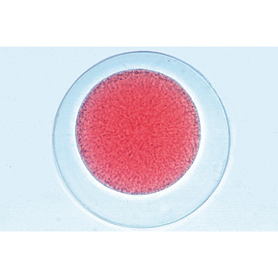 Embriologia de Ouriço-do-mar (Psammechinus miliaris) - Inglês, 1003984 [W13055], Preparados para microscopia LIEDER