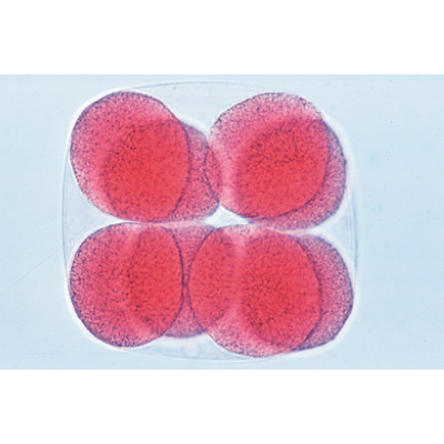 Embriologia de Ouriço-do-mar (Psammechinus miliaris) - Inglês, 1003984 [W13055], Preparados para microscopia LIEDER
