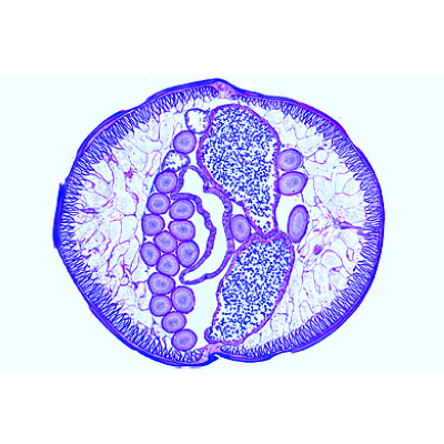The Ascaris megalocephala Embryology - German, 1013478 [W13084], 细胞分裂