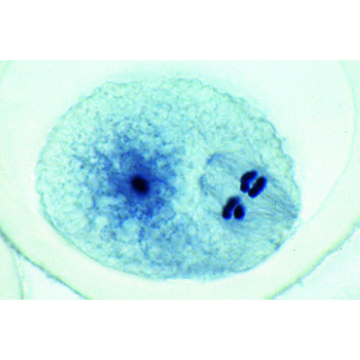 The Ascaris megalocephala Embryology - Portuguese, 1013482 [W13087], 细胞分裂