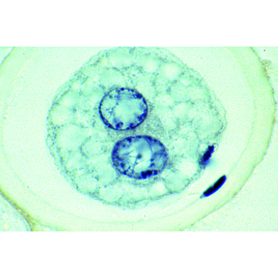 The Ascaris megalocephala Embryology - Portuguese, 1013482 [W13087], 葡萄牙语