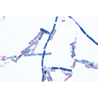 Pathogenic Bacteria - German Slides, 1004146 [W13324], 德语