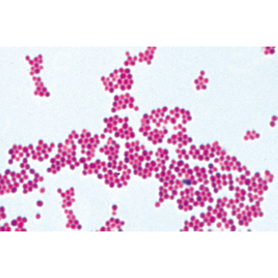 Bactérias Patogênicas - Inglês, 1004249 [W13424], Preparados para microscopia LIEDER