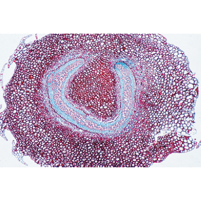 Disposição e Tipos de Feixes Vasculares - Inglês, 1004255 [W13430], Preparados para microscopia LIEDER