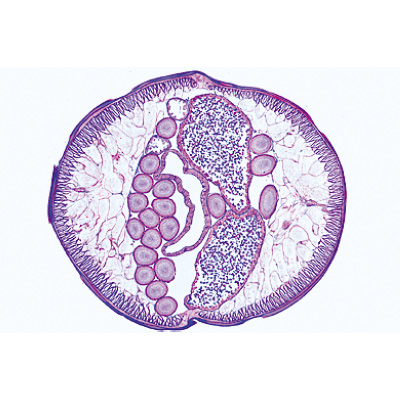 General Parasitology, Short Set - English Slides, 1004266 [W13441], Microscope Slides LIEDER