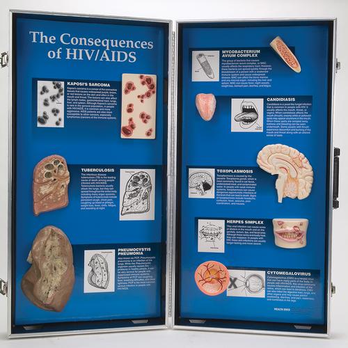 The Consequences Of Hiv Aids 3d Display 1018281 W43090 Wrs Group 79647 Condom