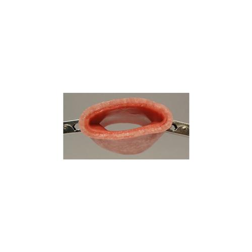 Vaginal cuff (2" wet), 1020370 [W44934], Consumables