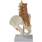 Pelvic Model with Lumbar Spine Muscles, 1019418, Modelos de Articulaciones