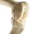 ORTHObones Стандартный Левое колено, 1019621, 3B ORTHObones Standard (Small)