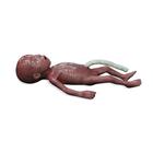 Lifecast Micro-preemie Baby / Extremely Low Birth Weight Baby (ELBW), 1024668, ALS Newborn