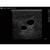 Blue Phantom Gen II - Automated Pump Transparent Ultrasound Central Line Training Model, 3012487, Ultrasound Skill Trainers (Small)