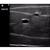 TruNerveBlock 3-in-1 ultrasound model, 1023064 [3012752], Adult Patient Care (Small)