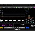 Philips IntelliVue MX800 Patient Monitor Screen Simulation for REALITi360, 8000974, 전문 외상처치술