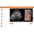 POCUS E-Sim Complete by GUSI & e Sono
1 utente 1 anno, 8001276, POCUS E-SIM Complete (Small)