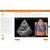 POCUS E-Sim Complete by GUSI & e Sono
1 utilisateur 1 an, 8001276, POCUS E-SIM Complet (Small)