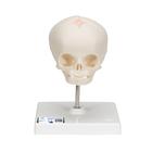 임신 30주째 태아 두개골(머리뼈)모형, 받침대포함  Foetal Skull Model, natural cast, 30th week of pregnancy, on stand, 1000058 [A26], 두개골 모형