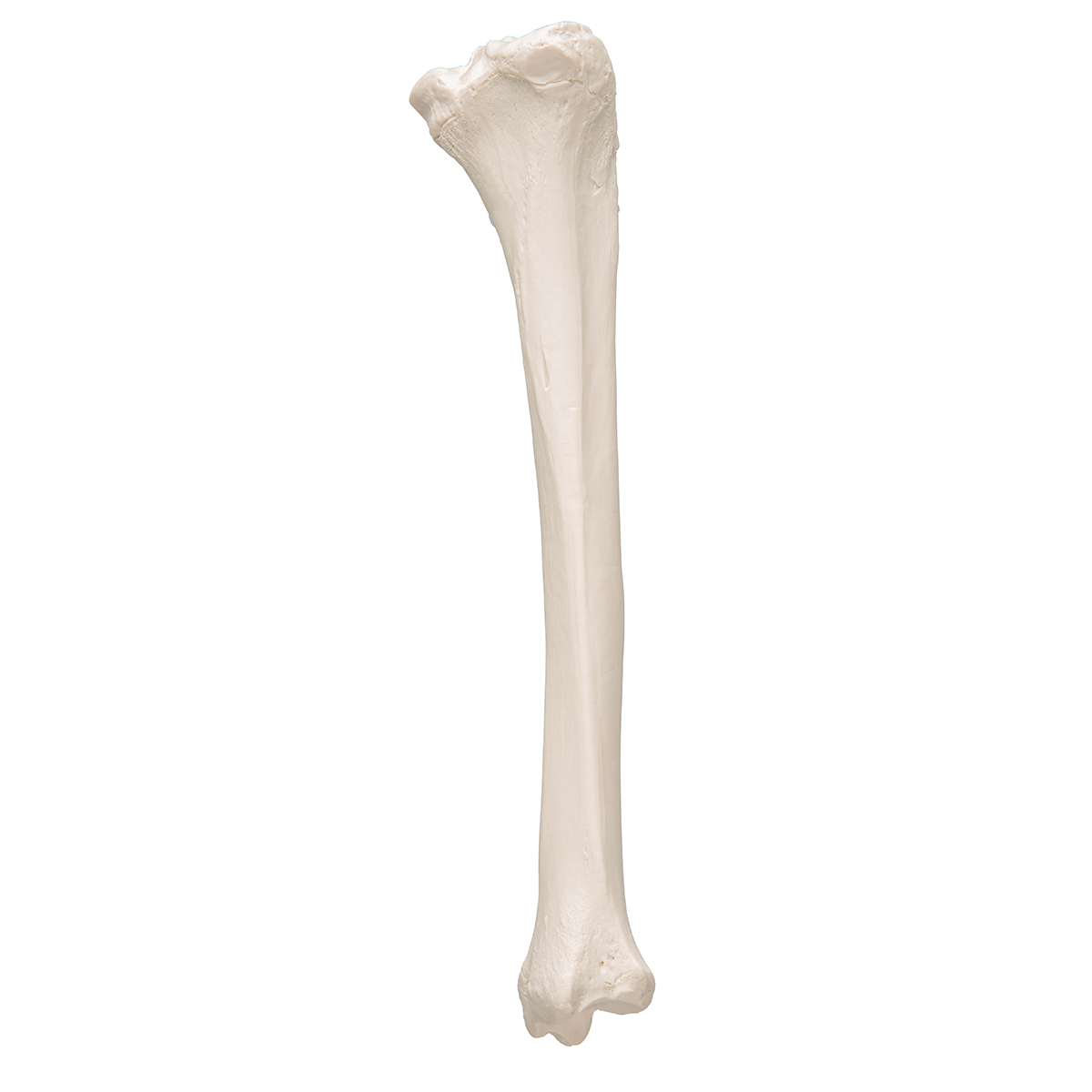Берцовая кость кость