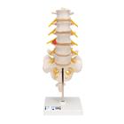 Columnavertebral lumbar con hernia discal dorsolateral, 1000150 [A76/5], Modelos de vértebras