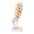 Human Lumbar Spinal Column Model with Dorso-Lateral Prolapsed Intervertebral Disc, 1000150 [A76/5], Vertebra Models (Small)