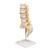 Human Lumbar Spinal Column Model with Dorso-Lateral Prolapsed Intervertebral Disc, 1000150 [A76/5], Vertebra Models (Small)